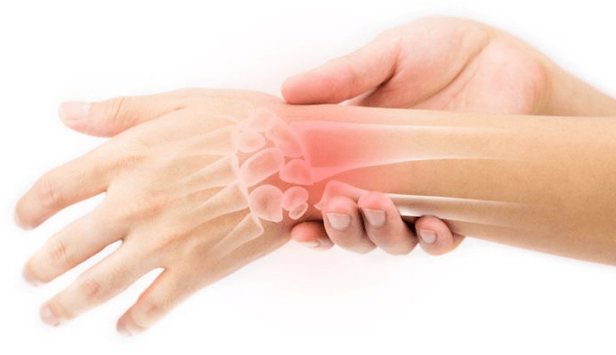 Doenças das articulações, cartilagens e ligamentos - indicações para o uso de Hondrocream