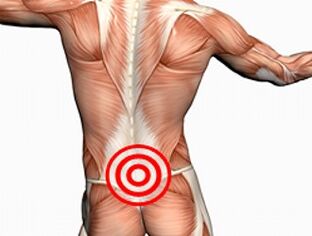 Osteocondrose da coluna lombar