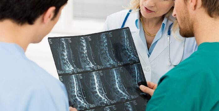 Radiografia da coluna vertebral como forma de diagnosticar osteocondrose