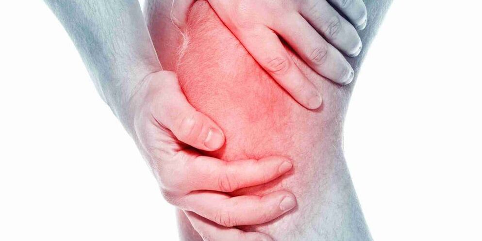 Dor no joelho com artrose
