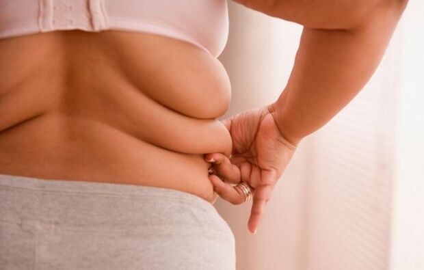 sobrepeso, a causa da osteocondrose cervical em mulheres com menos de 40 anos