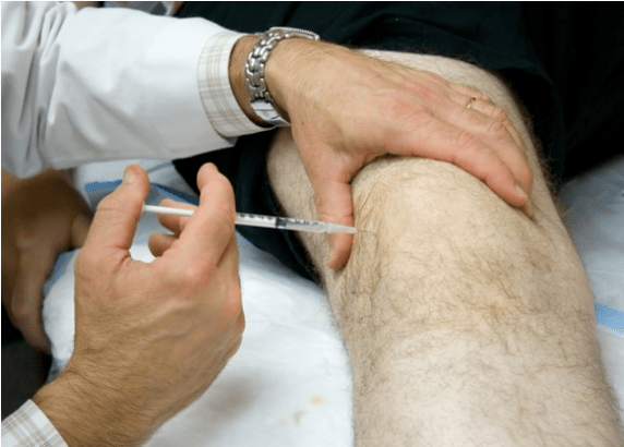 Administração intra -articular de analgésicos em dor intensa